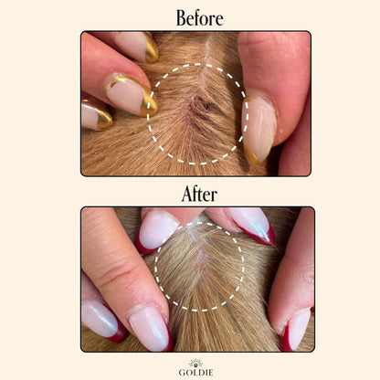 Miracle Mist: 4 oz
